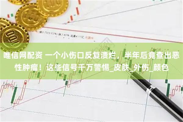 唯信网配资 一个小伤口反复溃烂，半年后竟查出恶性肿瘤！这些信号千万警惕_皮肤_外伤_颜色